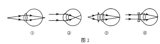 图2所示的四幅图,有的能够说明近视眼或远视眼的成像